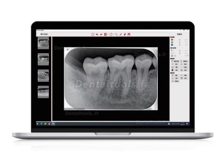 Runyes DS630 scanner PSP dentaire pour plaques d'imagerie radiographique